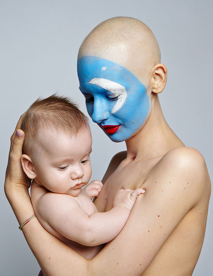 Фотография: Врачи сказали модели сделать аборт после того, как ей удалили 95% челюсти из-за рака, — и вот что она сделала №9 - BigPicture.ru