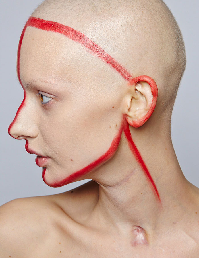Фотография: Врачи сказали модели сделать аборт после того, как ей удалили 95% челюсти из-за рака, — и вот что она сделала №12 - BigPicture.ru