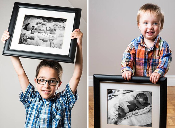 Фотография: До и после: сильные фото детей, которые появились на свет раньше срока №15 - BigPicture.ru