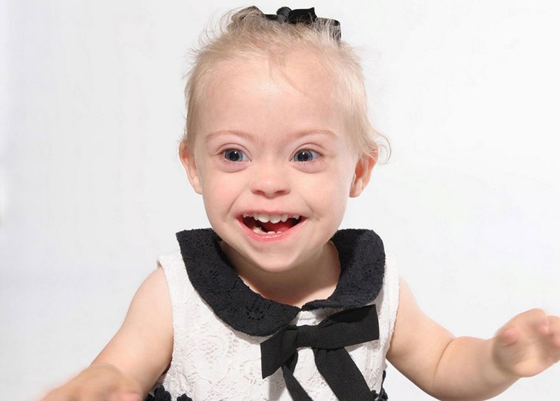 Фотография: Двухлетняя девочка с синдромом Дауна стала моделью благодаря своей лучезарной улыбке №1 - BigPicture.ru