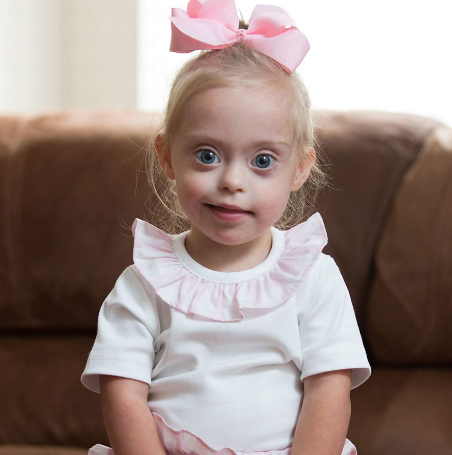 Фотография: Двухлетняя девочка с синдромом Дауна стала моделью благодаря своей лучезарной улыбке №2 - BigPicture.ru