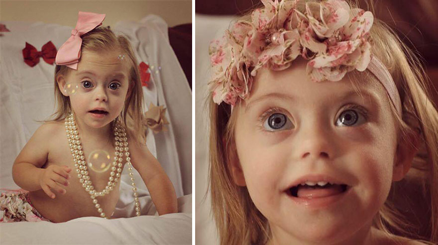 Фотография: Двухлетняя девочка с синдромом Дауна стала моделью благодаря своей лучезарной улыбке №3 - BigPicture.ru