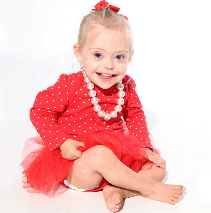 Фотография: Двухлетняя девочка с синдромом Дауна стала моделью благодаря своей лучезарной улыбке №4 - BigPicture.ru