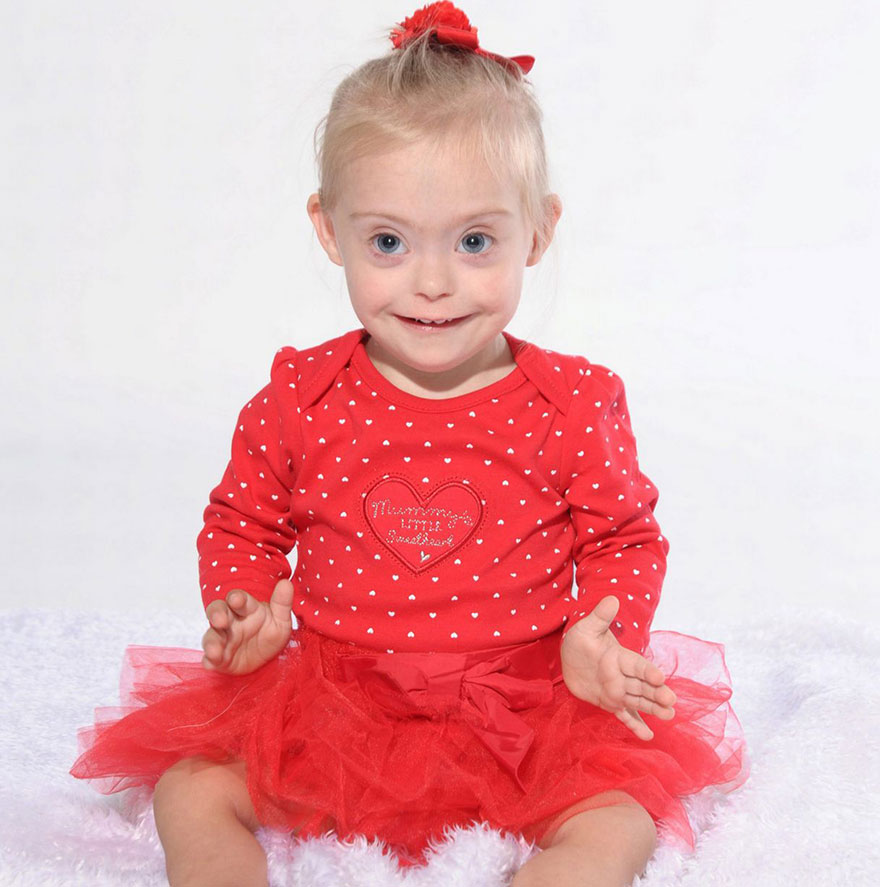 Фотография: Двухлетняя девочка с синдромом Дауна стала моделью благодаря своей лучезарной улыбке №8 - BigPicture.ru