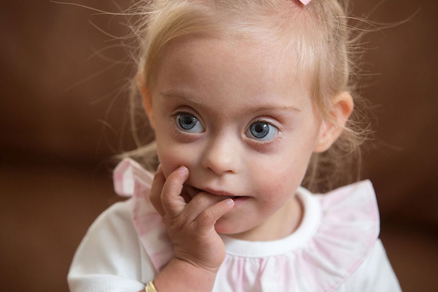 Фотография: Двухлетняя девочка с синдромом Дауна стала моделью благодаря своей лучезарной улыбке №10 - BigPicture.ru