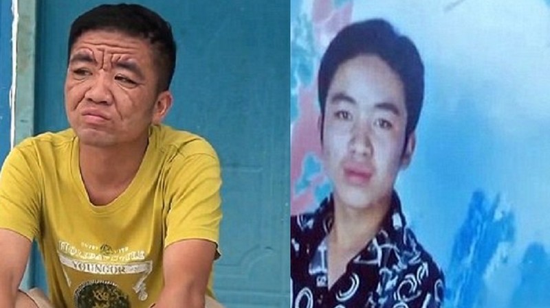 За 10 лет китайский юноша превратился в старика. ФОТО