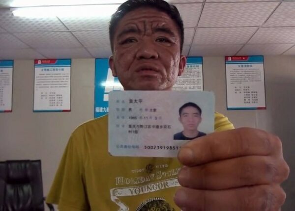 За 10 лет китайский юноша превратился в старика