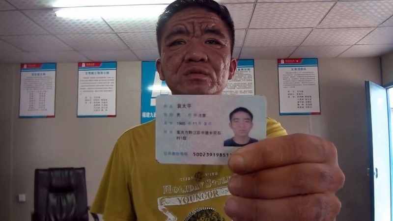 Фотография: За 10 лет китайский юноша превратился в старика №4 - BigPicture.ru