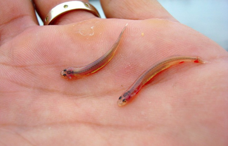 Фотография: 10 самых страшных паразитов, которые могут жить в человеческом теле №8 - BigPicture.ru