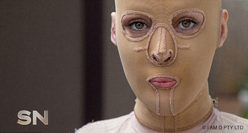 Фотография: Некогда чуть не сгоревшая заживо австралийка наконец сняла свою маску №16 - BigPicture.ru
