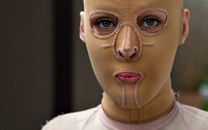 Фотография: Некогда чуть не сгоревшая заживо австралийка наконец сняла свою маску №1 - BigPicture.ru