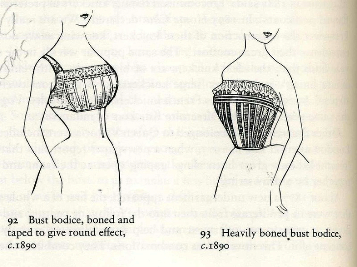 Увеличение груди 100 лет назад. Как это было?