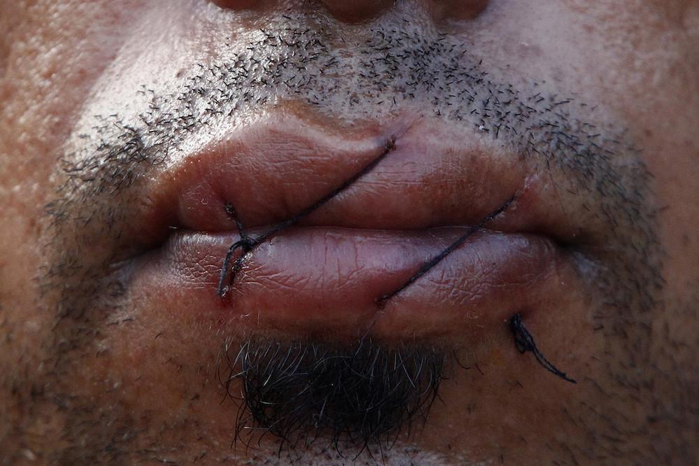 Фотография: Иранские беженцы зашили себе рты №14 - BigPicture.ru