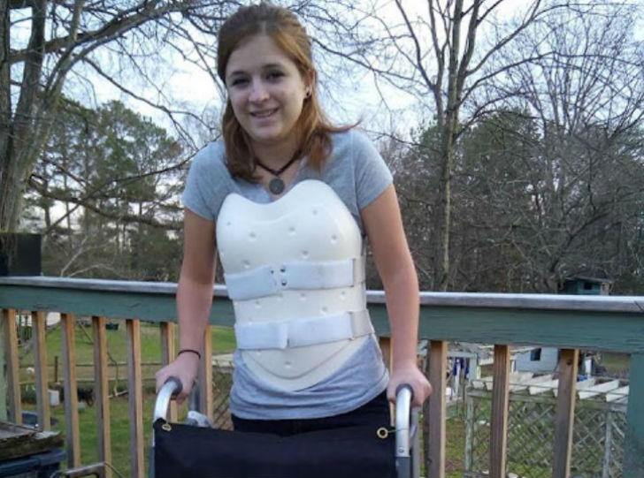 Фотография: Выжившая в автокатастрофе девушка сделала из корсета для спины броню в стиле стимпанк №1 - BigPicture.ru