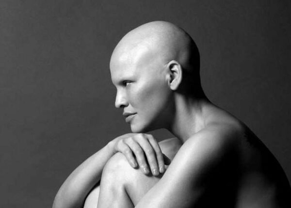 Модель Миеко Рай: «У меня рак груди третьей стадии, и я никогда не чувствовала себя более красивой»