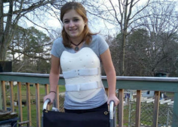 Выжившая в автокатастрофе девушка сделала из корсета для спины броню в стиле стимпанк