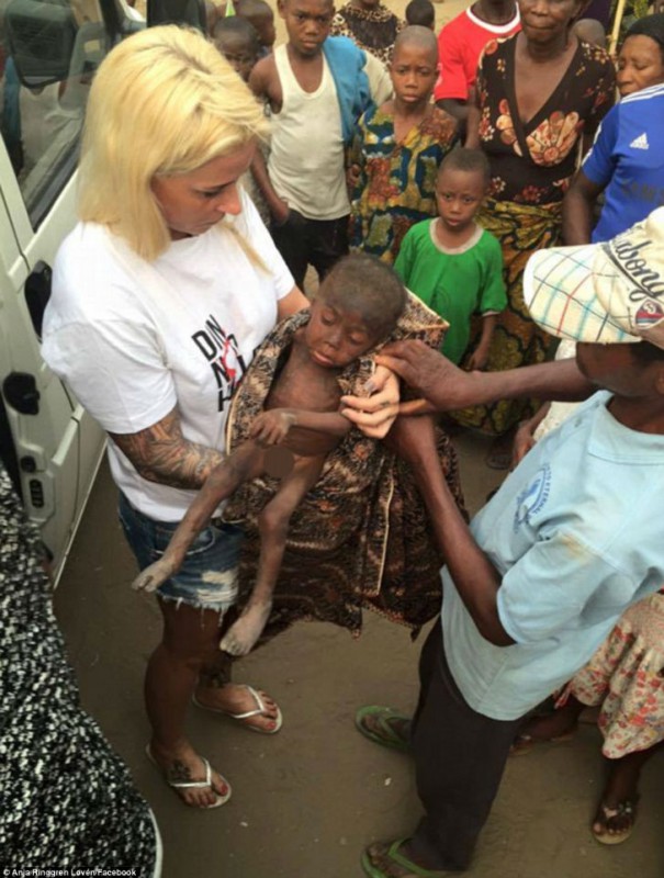 Фотография: Женщина спасла умирающего нигерийского малыша, которого выгнали на улицу собственные родители №5 - BigPicture.ru