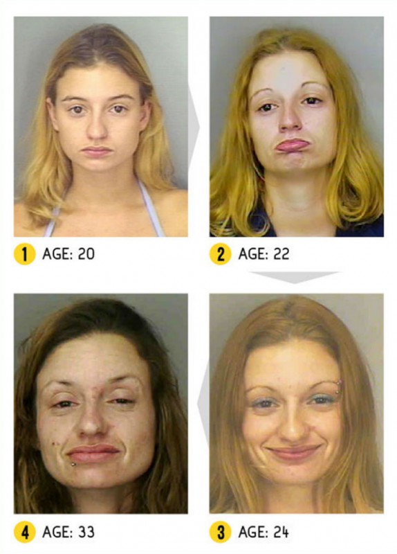 Фотография: Результат налицо — как меняется внешность человека из-за наркотиков №14 - BigPicture.ru