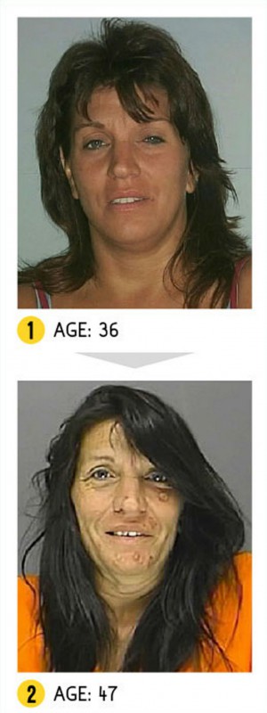 Фотография: Результат налицо — как меняется внешность человека из-за наркотиков №4 - BigPicture.ru
