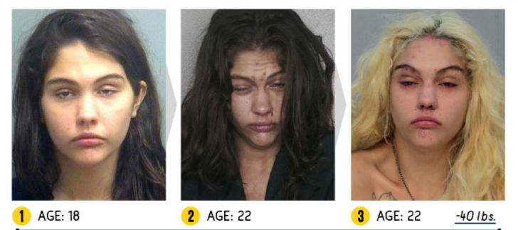 Фотография: Результат налицо — как меняется внешность человека из-за наркотиков №3 - BigPicture.ru