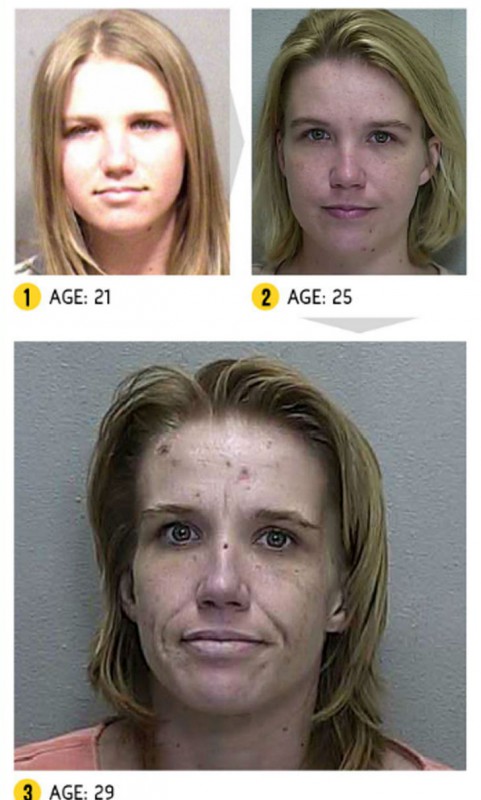 Фотография: Результат налицо — как меняется внешность человека из-за наркотиков №2 - BigPicture.ru