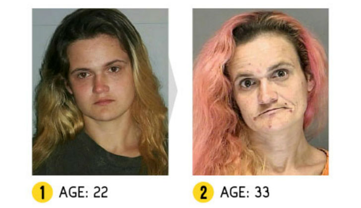 Фотография: Результат налицо — как меняется внешность человека из-за наркотиков №15 - BigPicture.ru