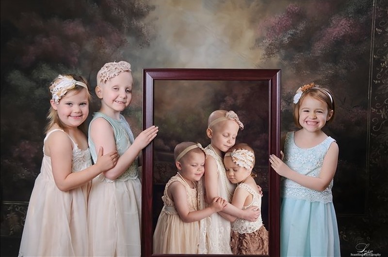 Фотография: Победившие рак: трогательная история трех малышек №2 - BigPicture.ru
