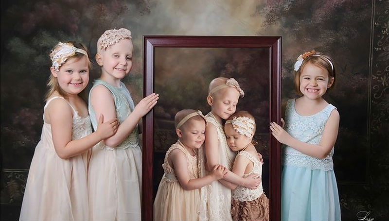 Фотография: Победившие рак: трогательная история трех малышек №1 - BigPicture.ru