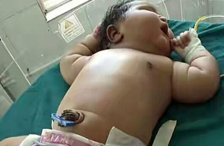 Фотография: 19-летняя мать родила самую тяжелую девочку весом 6,8 кг №1 - BigPicture.ru