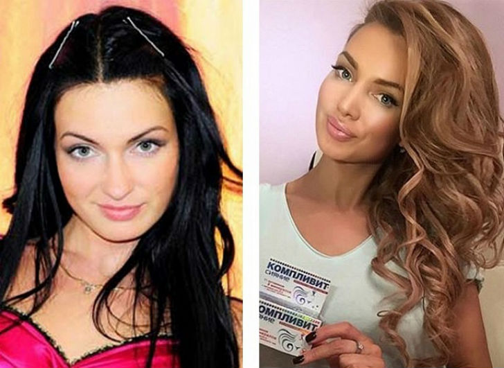 Фотография: 10 российских красавиц до и после пластики №11 - BigPicture.ru