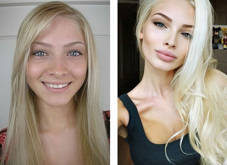 Фотография: 10 российских красавиц до и после пластики №2 - BigPicture.ru