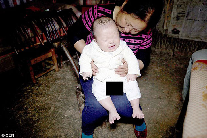 Фотография: В Китае родился мальчик с 31 пальцем №3 - BigPicture.ru