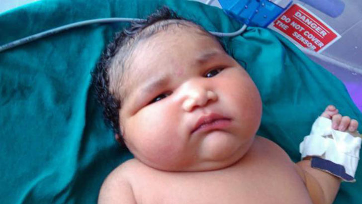 Фотография: 19-летняя мать родила самую тяжелую девочку весом 6,8 кг №4 - BigPicture.ru