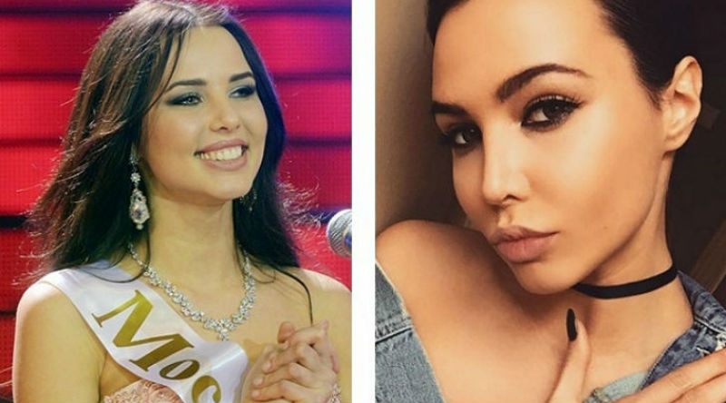 Фотография: 10 российских красавиц до и после пластики №1 - BigPicture.ru