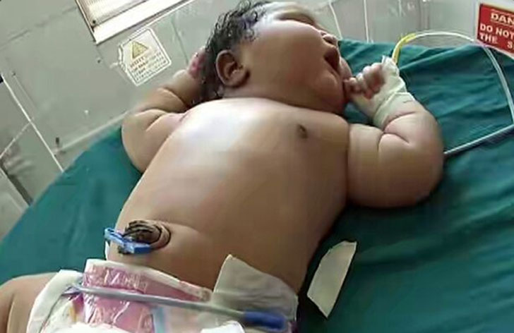 Фотография: 19-летняя мать родила самую тяжелую девочку весом 6,8 кг №7 - BigPicture.ru