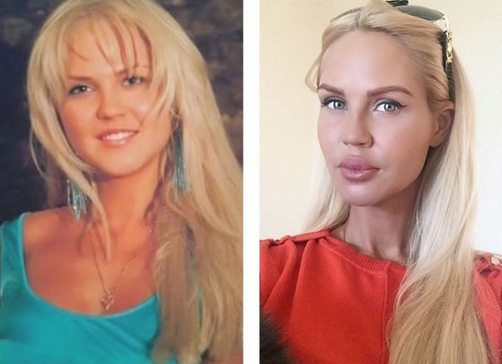 Фотография: 10 российских красавиц до и после пластики №8 - BigPicture.ru