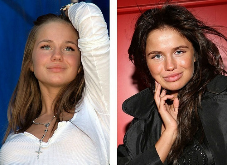 Фотография: 10 российских красавиц до и после пластики №9 - BigPicture.ru