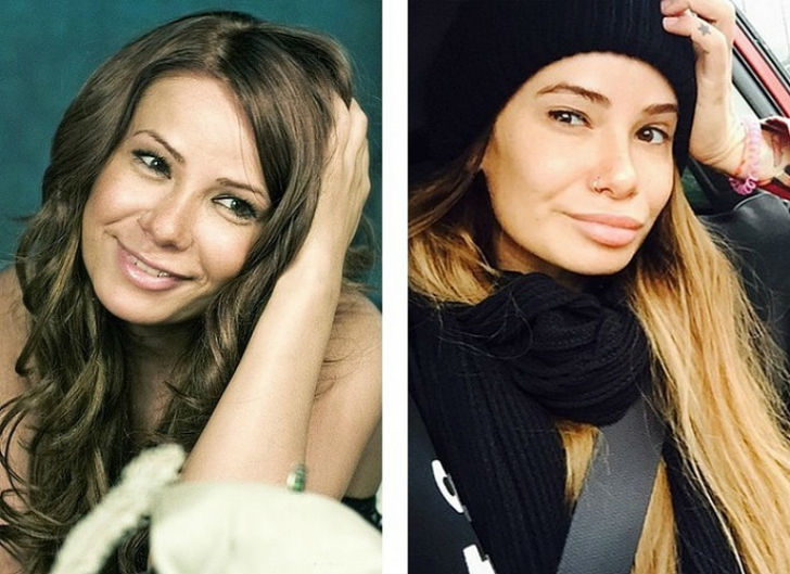 Фотография: 10 российских красавиц до и после пластики №10 - BigPicture.ru