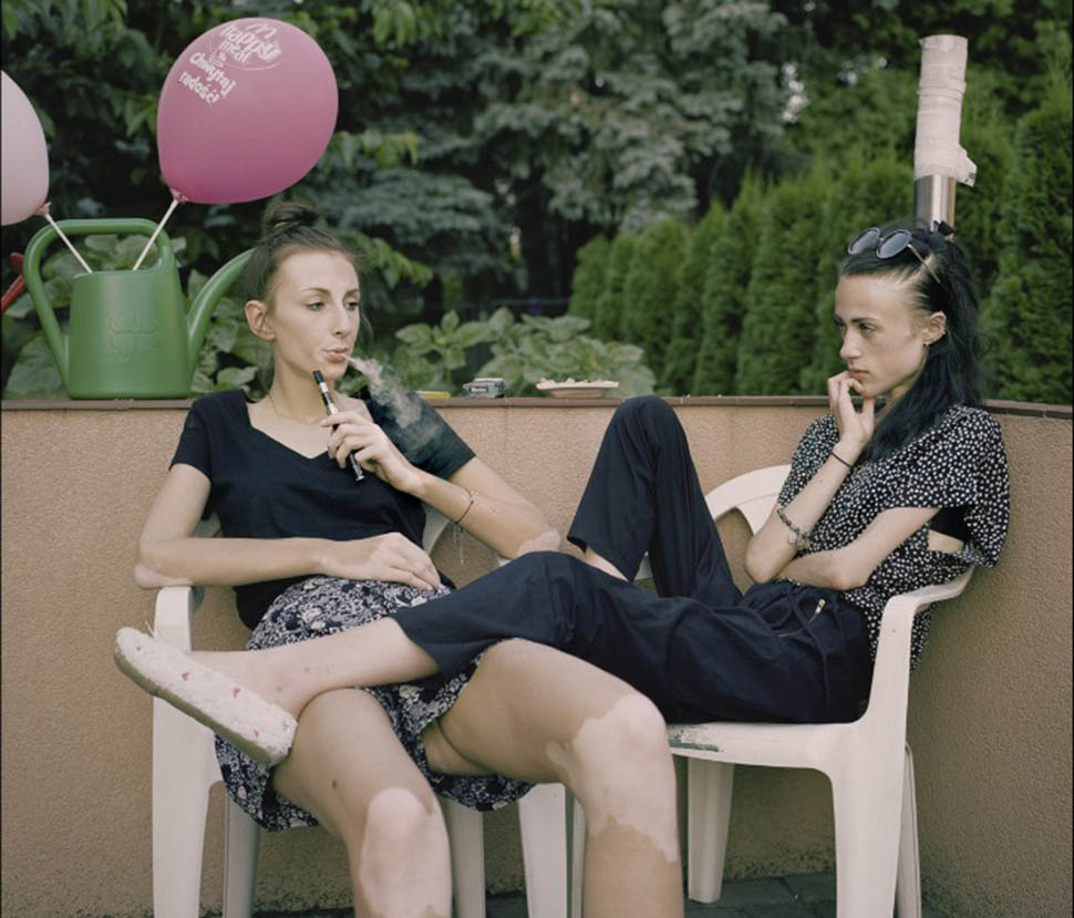Фотография: Домик в Польше, где девушки помогают друг другу бороться с анорексией №2 - BigPicture.ru