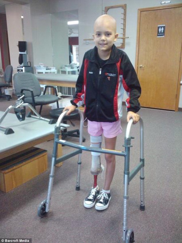 Фотография: Вдохновляющий пример: девушка с протезом ноги стала прекрасной танцовщицей №4 - BigPicture.ru