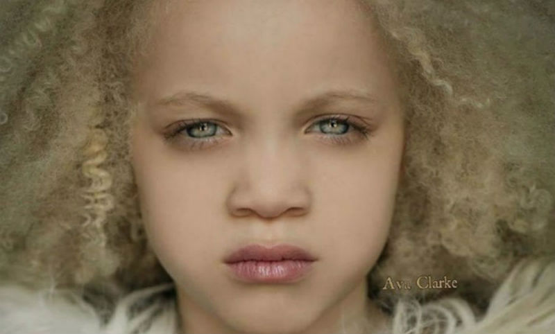 Фотография: Афроамериканская девочка-альбинос стала сенсацией в мире моды №1 - BigPicture.ru