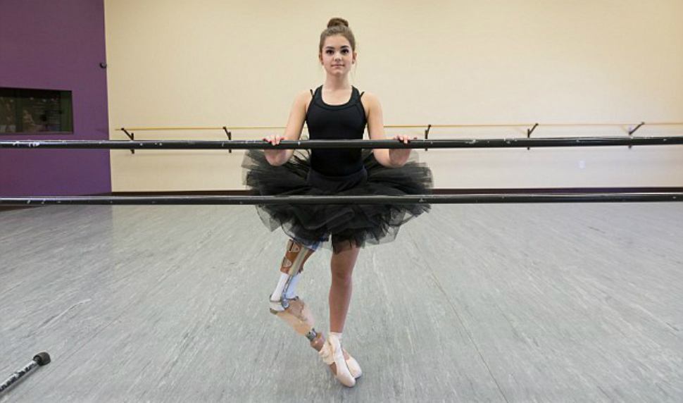 Фотография: Вдохновляющий пример: девушка с протезом ноги стала прекрасной танцовщицей №1 - BigPicture.ru