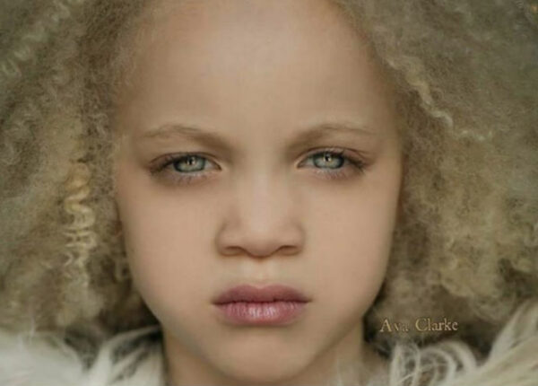 Афроамериканская девочка-альбинос стала сенсацией в мире моды