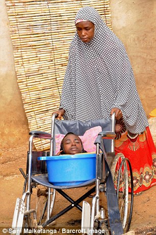 Фотография: Девушка из тазика: история нигерийки с головой взрослой женщины и телом младенца №3 - BigPicture.ru