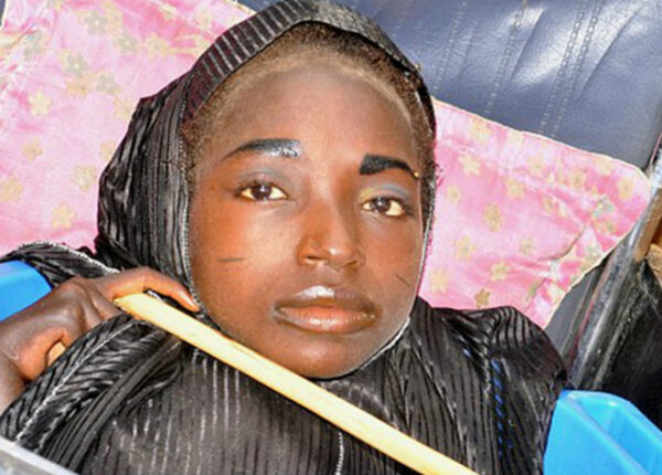 Девушка из тазика: история нигерийки с головой взрослой женщины и телом младенца