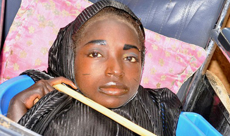 Фотография: Девушка из тазика: история нигерийки с головой взрослой женщины и телом младенца №1 - BigPicture.ru