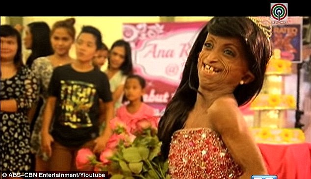Фотография: На Филиппинах умерла девушка с телом 150-летней старушки №4 - BigPicture.ru