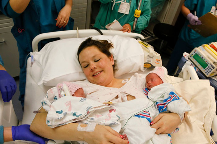 Фотография: Неразлучные двойняшки, державшие друг друга за руку при рождении, два года спустя №5 - BigPicture.ru