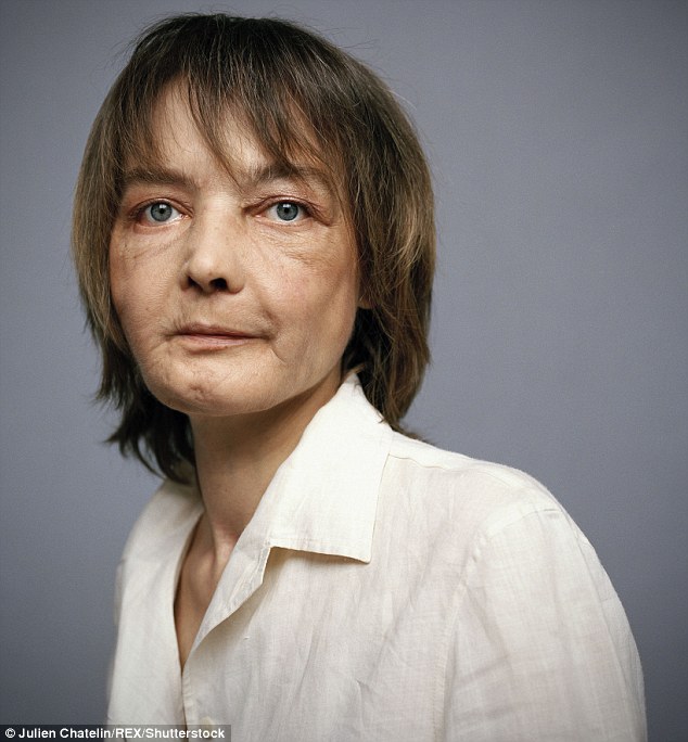 Фотография: Первая женщина с пересаженным лицом умерла от рака, вызванного лекарствами против отторжения трансплантатов №4 - BigPicture.ru