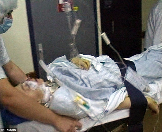 Фотография: Первая женщина с пересаженным лицом умерла от рака, вызванного лекарствами против отторжения трансплантатов №6 - BigPicture.ru